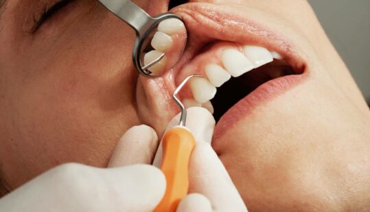 Dental Insurance In Spain For Expats
